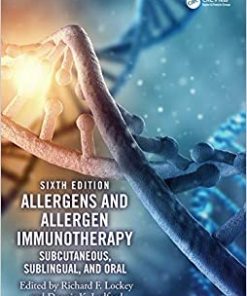 Allergens and Allergen Immunotherapy Subcutaneous Sublingual and Oral 6th Edition