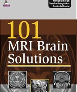 101 MRI Brain Solutions