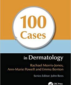 100 Cases In Dermatology