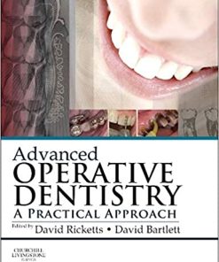 Advanced Operative Dentistry A Practical Approach