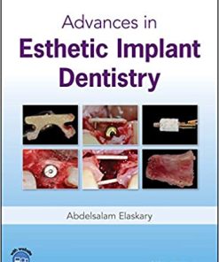 Advances In Esthetic Implant Dentistry