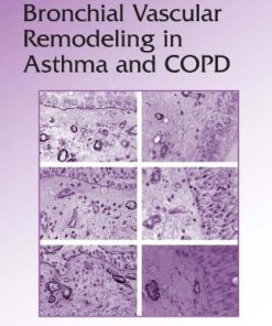 Bronchial Vascular Remodeling in Asthma and COPD