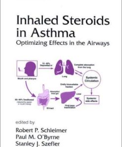 Inhaled Steroids in Asthma Optimizing Effects in the Airways