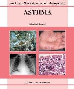 Asthma An Atlas of Investigation and Diagnosis