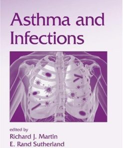 Asthma and Infections Volume 238