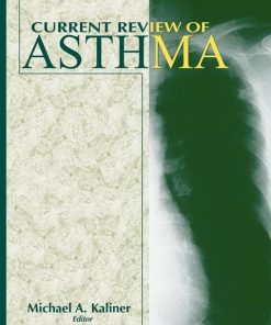 Current Review of Asthma