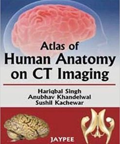 Atlas of Human Anatomy on CT Imaging