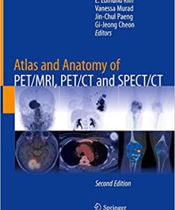 Atlas and Anatomy of PET MRI PET CT and SPECT CT 2nd Edition