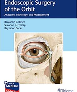 Endoscopic Surgery Of The Orbit Anatomy Pathology And Management