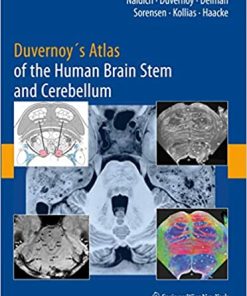 Duvernoy’s Atlas of the Human Brain Stem and Cerebellum High Field MRI Surface Anatomy Internal Structure Vascularization and 3D Sectional Anatomy