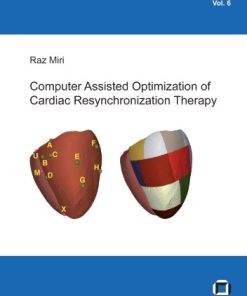 Computer Assisted Optimization of Cardiac Resynchronization Therapy