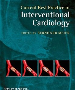 Current Best Practice in Interventional Cardiology