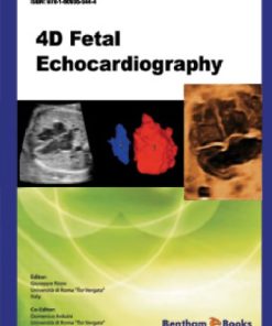 4D Fetal Echocardiography