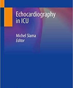 Echocardiography in ICU
