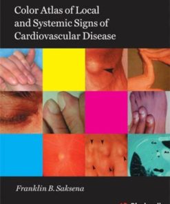 Color Atlas of Local and Systemic Manifestations of Cardiovascular Disease