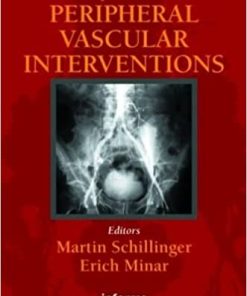 Complications in Peripheral Vascular Interventions