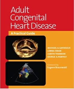 Adult Congenital Heart Disease A Practical Guide