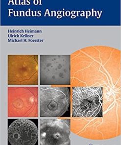 Atlas of Fundus Angiography