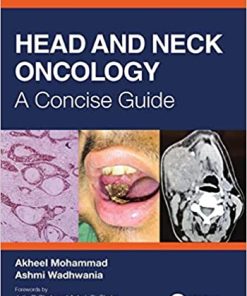 Head and Neck Oncology A Concise Guide