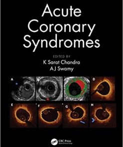 Acute Coronary Syndromes By K Sarat Chandra