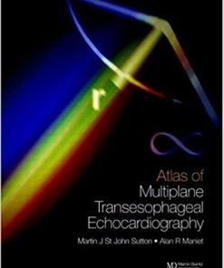 An Atlas of Multiplane Transesophageal Echocardiography