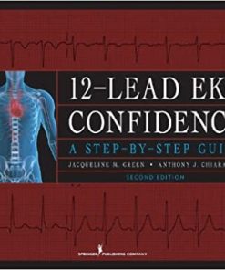 12 Lead EKG Confidence A Step By Step Guide