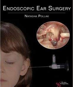 Endoscopic Ear Surgery