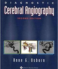 Diagnostic Cerebral Angiography
