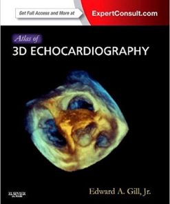 Atlas of 3D Echocardiography