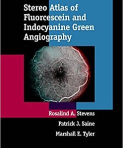 Stereo Atlas of Fluorescein and Indocyanine Green Angiography
