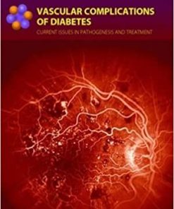 Vascular Complications of Diabetes Current Issues in Pathogenesis and Treatment