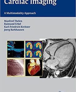 Cardiac Imaging A Multimodality Approach