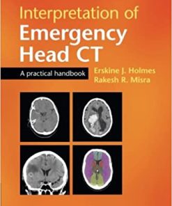 Interpretation of Emergency Head CT A Practical Handbook 2nd Ed