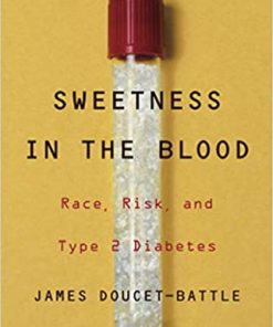 Sweetness in the Blood Race Risk and Type 2 Diabetes