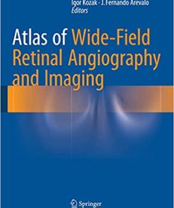 Atlas of Wide Field Retinal Angiography and Imaging