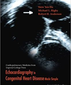 Echocardiography in Congenital Heart Disease Made Simple