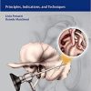 Endoscopic Ear Surgery Principles Indications and Techniques
