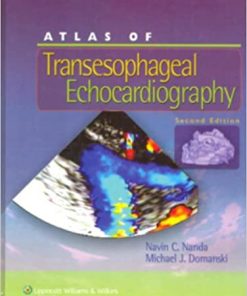 Atlas of Transesophageal Echocardiography 2nd Edition