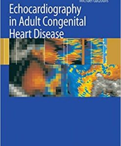 Echocardiography in Adult Congenital Heart Disease