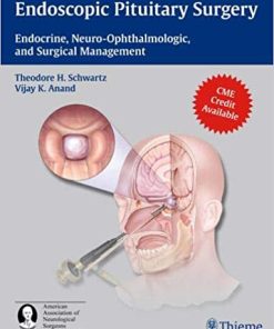 Endoscopic Pituitary Surgery Endocrine Neuro Ophthalmologic and Surgical Management