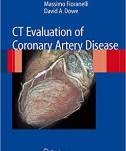 CT Evaluation of Coronary Artery Disease
