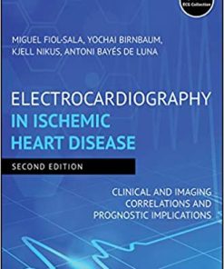 Electrocardiography in Ischemic Heart Disease Clinical and Imaging Correlations and Prognostic Implications 2nd Ed