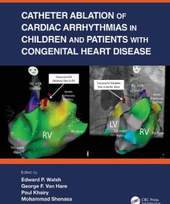 Catheter Ablation of Cardiac Arrhythmias in Children and Patients with Congenital Heart Disease