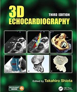 3D Echocardiography 3rd Edition
