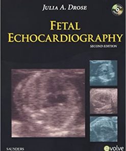 Fetal Echocardiography 2nd Edition By Julia A Drose