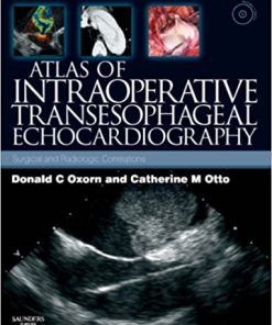 Atlas of Intraoperative Transesophageal Echocardiography