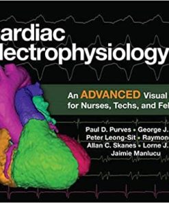 Cardiac Electrophysiology 2 An Advanced Visual Guide for Nurses Techs and Fellows