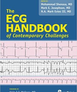 ECG Handbook of Contemporary Challenges