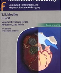 Pocket Atlas Of Sectional Anatomy Computed Tomography and Magnetic Resonance Volume II Thorax Heart Abdomen and Pelvisimaging
