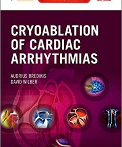 Cryoablation of Cardiac Arrhythmias